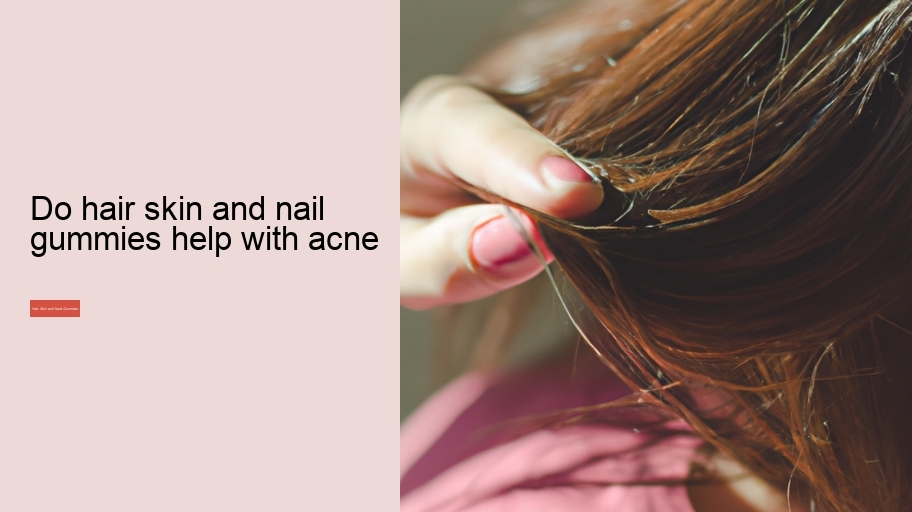do hair skin and nail gummies help with acne
