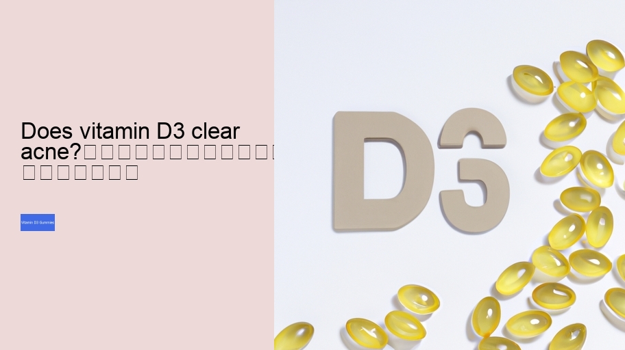 Does vitamin D3 clear acne?																									